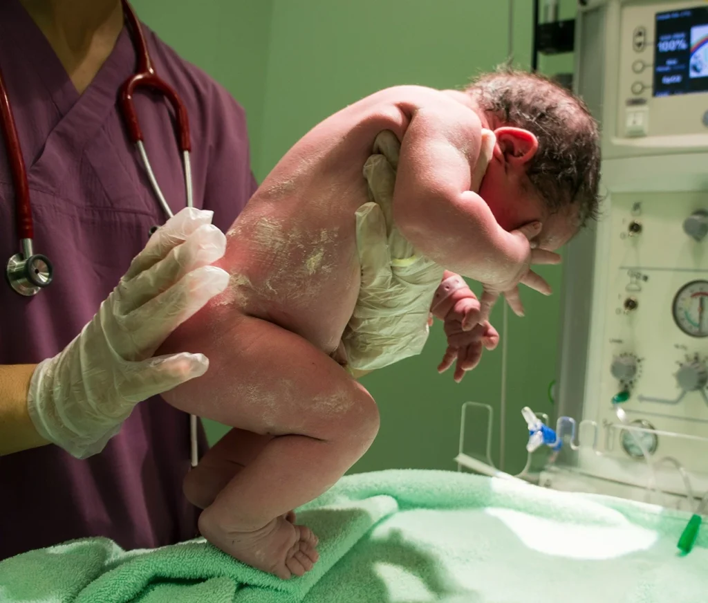 vernix caseosa